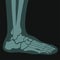 Xray of foot, joints and bones roentgen scans
