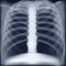 Xray medical image of chest