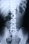 Xray/spine 1