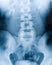 Xray Spine Human