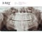 Xray teeth mouth dental tomography. Vector X-ray radiology oral panorama. Medical skeleton x ray background.