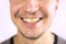 Yellow damaged tooth of a smiling Caucasian man in close-up. Focus on the teeth. Dental problems  dead teeth  enamel whitening