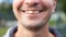 Yellow damaged tooth of a smiling Caucasian man in close-up. Focus on the teeth. Dental problems, dead teeth, enamel whitening, ae