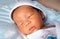 Yellow skin colored neonatal jaundice happen in new born baby infant