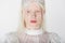 Young albino woman in guipure blouse