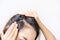 Young asian women worried about hair loss problems