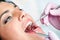 Young girl having dental check up