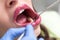 Young girl having dental check up