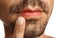 Young man with cold sore touching lips against background, closeup