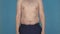 A young man with a naked fat belly jumps and shakes fat folds and cellulite on the stomach, the concept of malnutrition