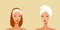 young woman before and after acne treatment skin care concept horizontal portrait