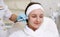 A young woman receiving a facial rejuvenation. Facial Hydro Microdermabrasion Peeling Treatment