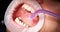 Young woman with retractor in mouth in dental clinic