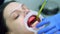 Young woman with retractor in the mouth is lying in dentist chair.