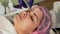The young woman`s face during the procedure closeup. Innovative cosmetic procedure. Medical procedure rejuvenation.