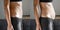 Before and after young woman side view of body. Swollen belly. Pregnancy. Diastasis recti after child birth. Fitness