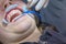 young woman or teenage girl having braces fitted at dentist