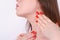 Young woman touching her neck and face. Plastic surgery, face li