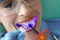 Young woman treating teeth with cordless LED curing light machine closeup