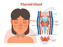 甲状腺解剖传染媒介例证图 教育医疗计划向量例证 插画包括有软骨 内部 医疗 女主持人 激素 甲状腺解剖传染媒介例证图 教育医疗计划向量例证 插画包括有软骨 内部 医疗 女主持人 激素