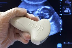 Abdominal- ultrasoud Prüfspitzenfötusscan-Hintergrund lizenzfreie stockfotografie Abdominal- ultrasoud Prüfspitzenfötusscan-Hintergrund lizenzfreie stockfotografie