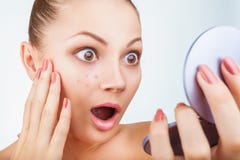 Acne In Women Royalty Free Stock Images