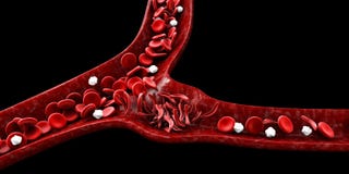 Anemia da célula falciforme, ilustração que mostra o vaso sanguíneo com crescente normal e deformado ilustração stock Anemia da célula falciforme, ilustração que mostra o vaso sanguíneo com crescente normal e deformado ilustração stock
