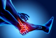 Ankle painful - skeleton x-ray. Royalty Free Stock Images Ankle painful - skeleton x-ray. Royalty Free Stock Images