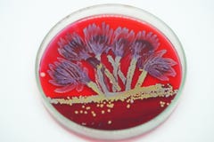 Art from Colony of bacteria in culture medium plate Stock Images Art from Colony of bacteria in culture medium plate Stock Images