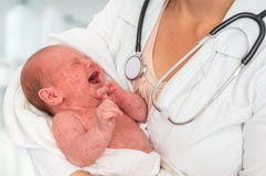 Arts die een pasgeboren baby houden wat zieke rode hond of mazelen is stock foto Arts die een pasgeboren baby houden wat zieke rode hond of mazelen is stock foto