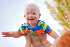 Baby with Down syndrome royalty free stock photography Baby with Down syndrome royalty free stock photography