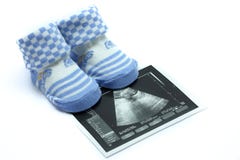 Baby Shoe Stock Photos Baby Shoe Stock Photos