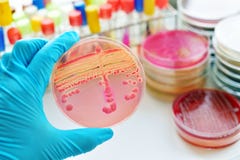 Bacteria culture