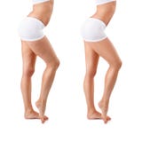 Before And After, Cellulite Concept Royalty Free Stock Photo Before And After, Cellulite Concept Royalty Free Stock Photo