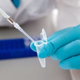 Biologische Lösung im eppendorf stockfotos Biologische Lösung im eppendorf stockfotos