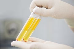 Blodplasma i provrör för plasmalifting fotografering för bildbyråer Blodplasma i provrör för plasmalifting fotografering för bildbyråer