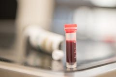 Bloedmonsters voor analyse in een reageerbuis stock fotografie Bloedmonsters voor analyse in een reageerbuis stock fotografie