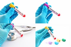 Blood For Sex Hormone Test Stock Photos