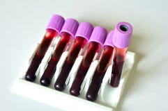 Blood Sample Royalty Free Stock Photography