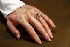 Bloody Hand Stock Photo Bloody Hand Stock Photo