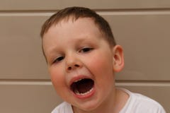 Boy, child, in a white T-shirt opened his mouth on examination with a doctor. a dentist or an otolaryngologist. fix bite of teeth. royalty free stock photos Boy, child, in a white T-shirt opened his mouth on examination with a doctor. a dentist or an otolaryngologist. fix bite of teeth. royalty free stock photos