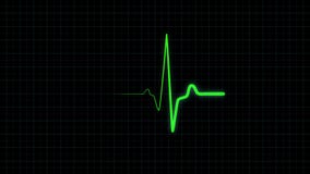 Green Heartbeat Line on EKG Screen with Grid Background Stock Video - Video of emergency, line: 158481469 Green Heartbeat Line on EKG Screen with Grid Background Stock Video - Video of emergency, line: 158481469
