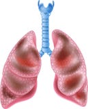Cartoon Illustration of Smokers Lungs on white background vector illustration Cartoon Illustration of Smokers Lungs on white background vector illustration