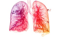 Chest X-rays under 3d image ,lungs 3d image royalty free illustration Chest X-rays under 3d image ,lungs 3d image royalty free illustration