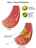 Cholesterol Cholesterol
