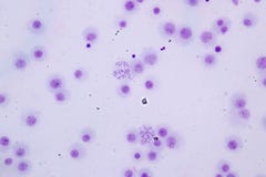 Chromosomes Human under the microscope for education. royalty free stock photography Chromosomes Human under the microscope for education. royalty free stock photography