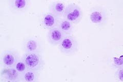 Chromosomes Human under the microscope for education. stock photo Chromosomes Human under the microscope for education. stock photo