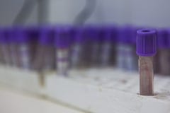 Clinical analysis tubes, usually used for blood tests. Stock Image Clinical analysis tubes, usually used for blood tests. Stock Image