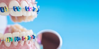 Close Up Dentist Tools And Orthodontic Model. Royalty Free Stock Photography