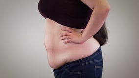 Close-up of fat unrecognizable Caucasian woman retracting belly and relaxing. Side view of obese woman`s body. Obesity